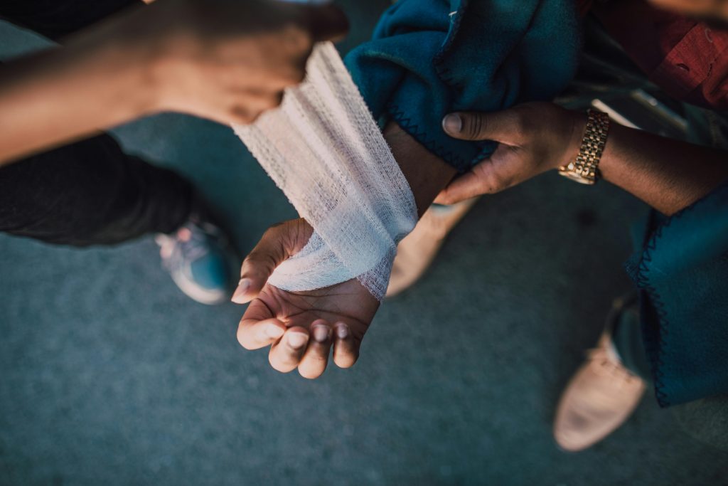 burn first aid covering wound with sterile gauze